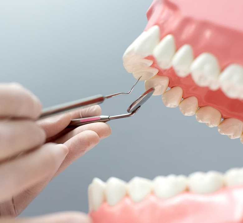 Periodoncia - Servicios YanesDent