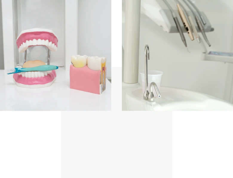 Servicios YanesDent - Tratamientos Periodoncia