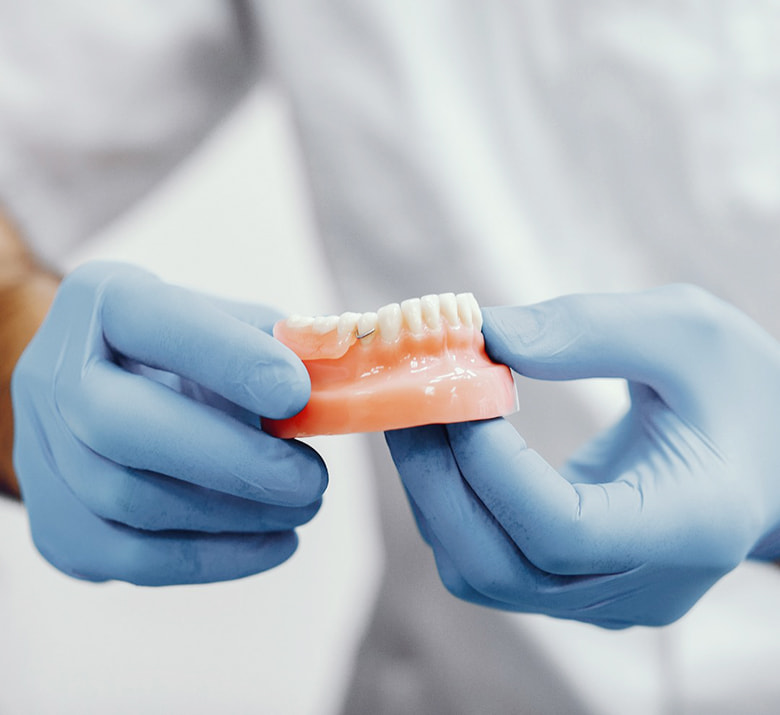 Implantes dentales - Servicios YanesDent