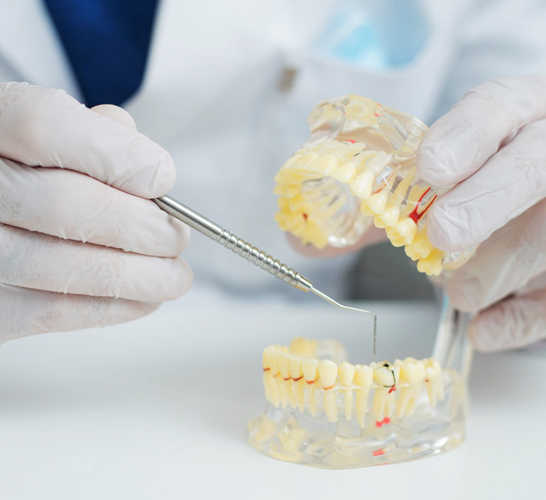Odontología conservadora - Servicios YanesDent